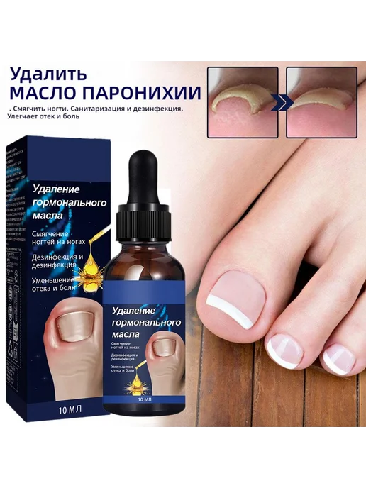 Масло для ногтей, уход и профилактика вросших ногтей 10ml, 10 мл, фото 2