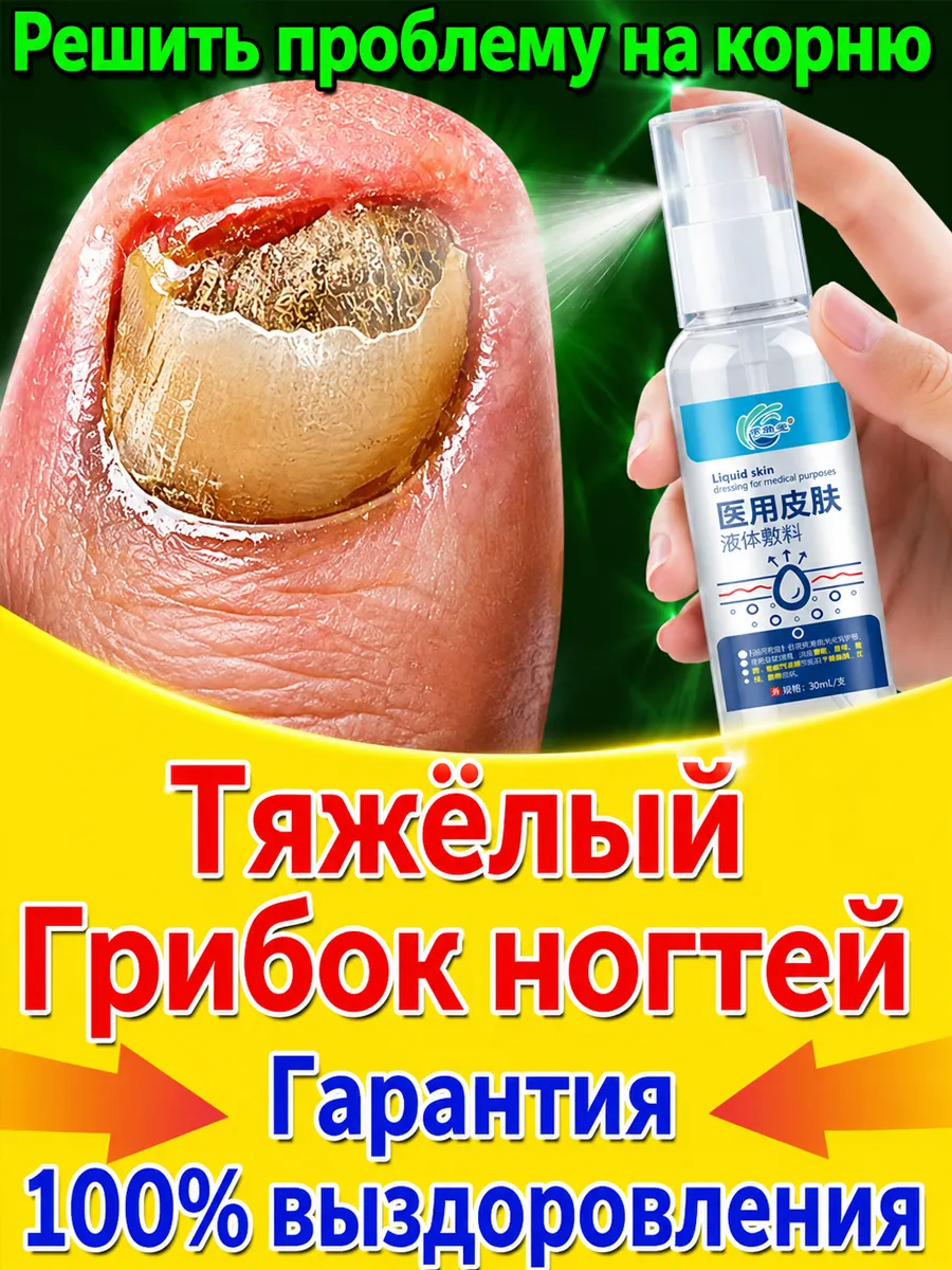 Спрей от грибка ногтей на ногах стоп онихолизис