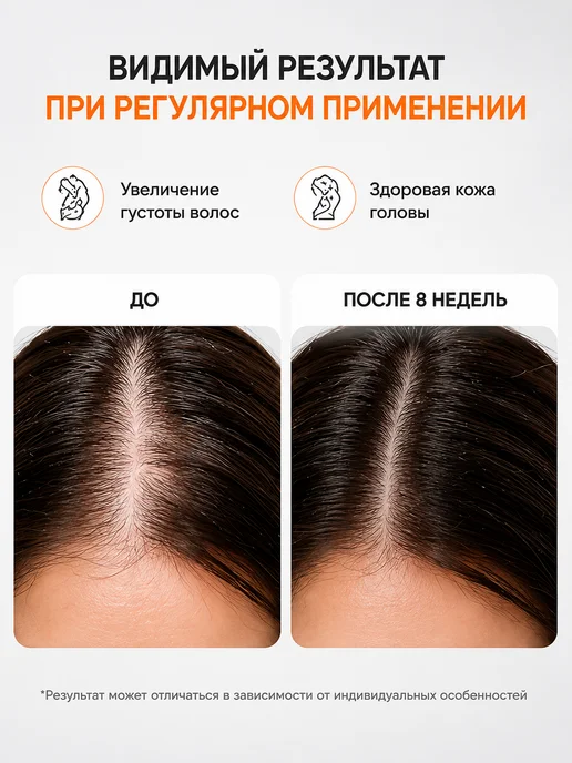 [Официальная bнутренняя доставка] Ампула для блеска и вос, вариант, фото 3