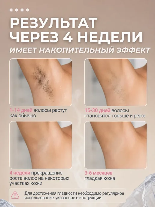 ComfuCo Фотоэпилятор лазерный профессиональный для удаления волос, белый, фото 6
