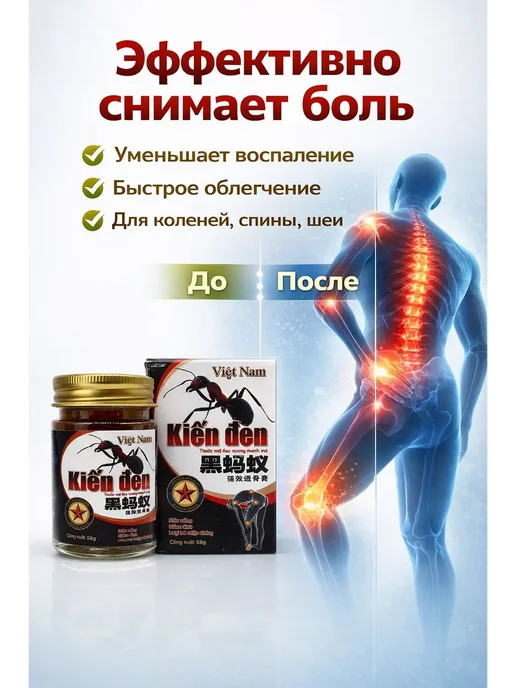 Муса02 Мазь черный муравей от боли в суставах и костях, черный, фото 2