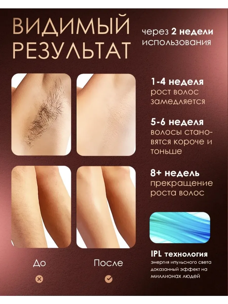 Фотоэпилятор лазерный для удаления волос на теле и лице — фото 5