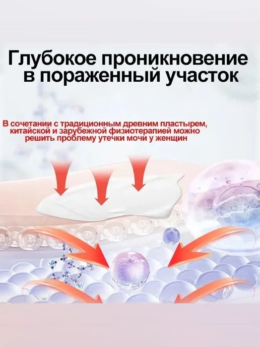 Лечение недержания мочи, как противовоспалительное, и, вариант, фото 8